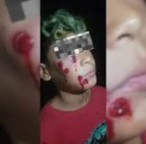 BONAERENSE: BALAS EN LA CARA A UN NIÑO DE 10 AÑOS FRENTE A UN COMEDOR DEL POLO OBRERO