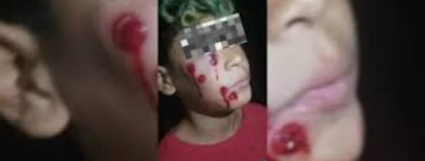 BONAERENSE: BALAS EN LA CARA A UN NIÑO DE 10 AÑOS FRENTE A UN COMEDOR DEL POLO OBRERO