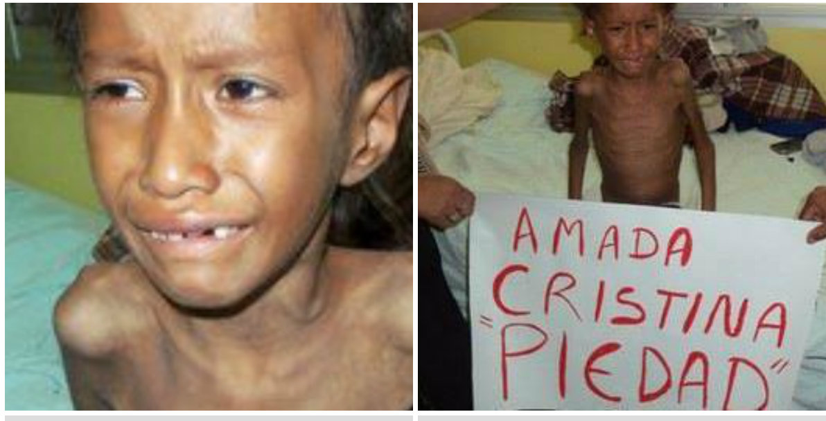 Murió Néstor Femenía, el niño qom afectado de tuberculosis y desnutrición